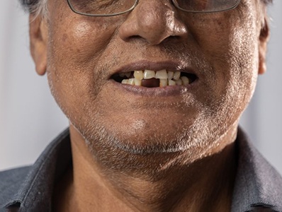 Man has missing teeth