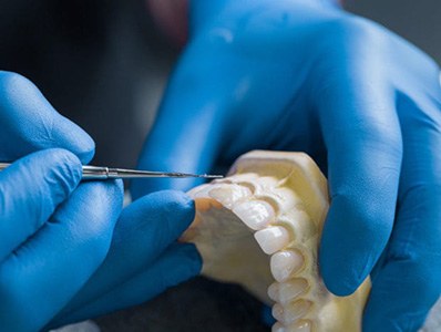 Dentist working on teeth model for restorative dentistry treatment